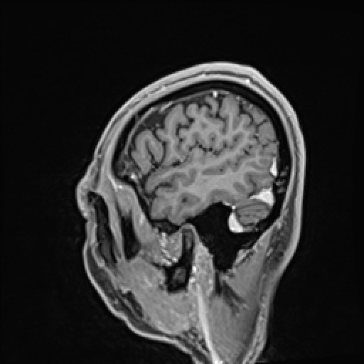 Click on the Serie image to view the images of VILLANUEVA, WILLIAM A.